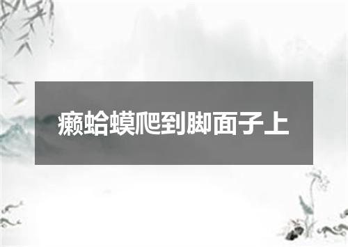 癞蛤蟆爬到脚面子上